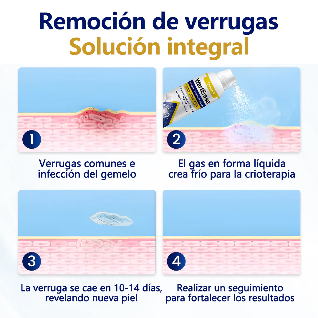 Tainun® ChillErase – spray reparador de cicatrices de acné ✨ | Elimina de forma segura verrugas, marcas y pequeñas protuberancias en casa ✅