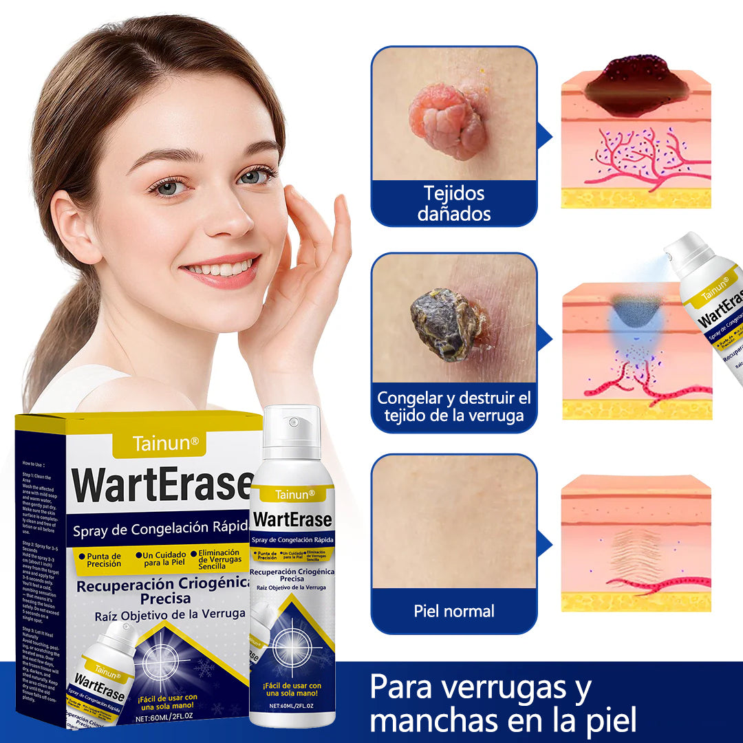 Tainun® ChillErase – spray reparador de cicatrices de acné ✨ | Elimina de forma segura verrugas, marcas y pequeñas protuberancias en casa ✅