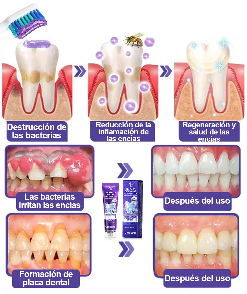 Guxar® VioCore Pasta Dental de Propóleo 🦷 Alivio del dolor dental en 3 días · Regeneración de las encías en 7 días · Prevención de la enfermedad periodontal · Combinación perfecta de veneno de abeja y minerales naturales 🌟