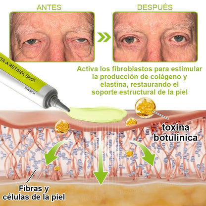 Vosxu™ Botox & Vita-A Retinol Shot sérum lifting antiarrugas ✨ – 💉 Microagujas | 💪 Péptidos con efecto botox | 🌿 Retinol | ⚡ Resultados visibles en 3 días 💎
