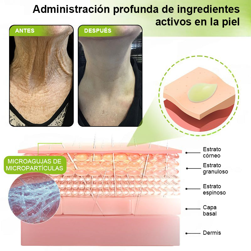 Vosxu™ Botox & Vita-A Retinol Shot sérum lifting antiarrugas ✨ – 💉 Microagujas | 💪 Péptidos con efecto botox | 🌿 Retinol | ⚡ Resultados visibles en 3 días 💎