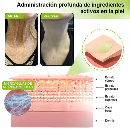 Vosxu™ Botox & Vita-A Retinol Shot sérum lifting antiarrugas ✨ – 💉 Microagujas | 💪 Péptidos con efecto botox | 🌿 Retinol | ⚡ Resultados visibles en 3 días 💎