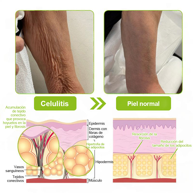 Vosxu™ Botox & Vita-A Retinol Shot sérum lifting antiarrugas ✨ – 💉 Microagujas | 💪 Péptidos con efecto botox | 🌿 Retinol | ⚡ Resultados visibles en 3 días 💎