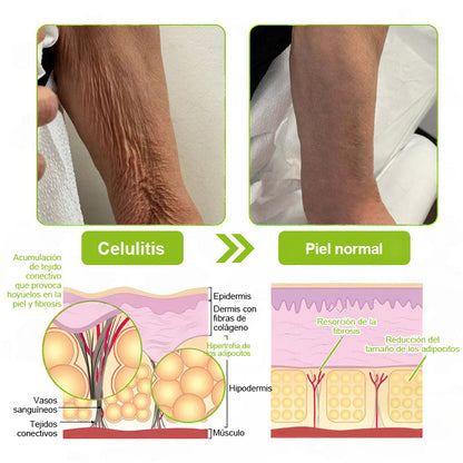 Vosxu™ Botox & Vita-A Retinol Shot sérum lifting antiarrugas ✨ – 💉 Microagujas | 💪 Péptidos con efecto botox | 🌿 Retinol | ⚡ Resultados visibles en 3 días 💎