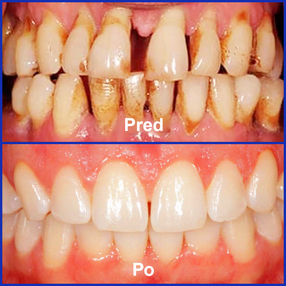 Guxar® VioCore Pasta Dental de Propóleo 🦷 Alivio del dolor dental en 3 días · Regeneración de las encías en 7 días · Prevención de la enfermedad periodontal · Combinación perfecta de veneno de abeja y minerales naturales 🌟