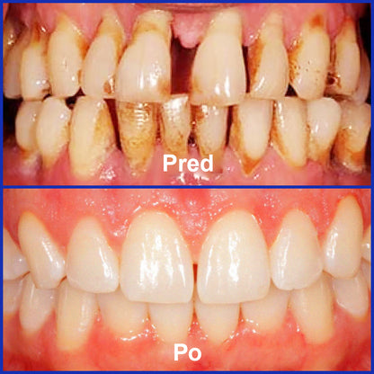 Guxar® VioCore Pasta Dental de Propóleo 🦷 Alivio del dolor dental en 3 días · Regeneración de las encías en 7 días · Prevención de la enfermedad periodontal · Combinación perfecta de veneno de abeja y minerales naturales 🌟
