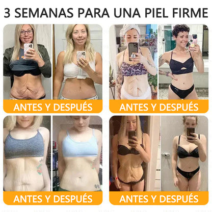 ✨Twisma® Veneno de Abeja Crema Renovadora de Piel con 🔥 ÚLTIMO DÍA 80% DE DESCUENTO 🐝