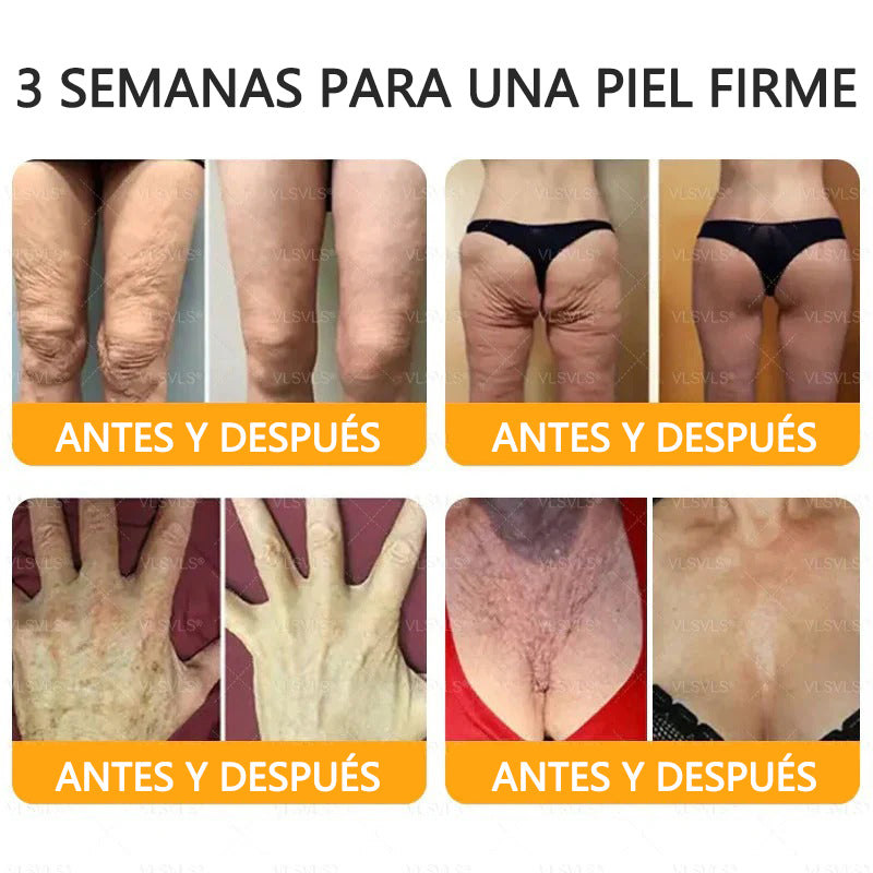 ✨Twisma® Veneno de Abeja Crema Renovadora de Piel con 🔥 ÚLTIMO DÍA 80% DE DESCUENTO 🐝