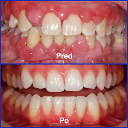 Guxar® VioCore Pasta Dental de Propóleo 🦷 Alivio del dolor dental en 3 días · Regeneración de las encías en 7 días · Prevención de la enfermedad periodontal · Combinación perfecta de veneno de abeja y minerales naturales 🌟