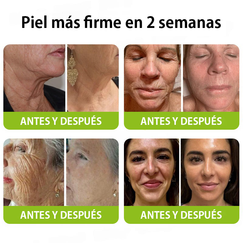 Vosxu™ Botox & Vita-A Retinol Shot sérum lifting antiarrugas ✨ – 💉 Microagujas | 💪 Péptidos con efecto botox | 🌿 Retinol | ⚡ Resultados visibles en 3 días 💎