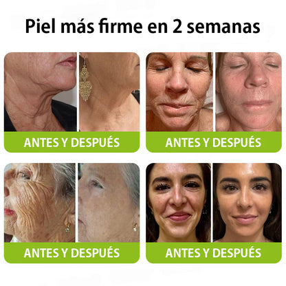 Vosxu™ Botox & Vita-A Retinol Shot sérum lifting antiarrugas ✨ – 💉 Microagujas | 💪 Péptidos con efecto botox | 🌿 Retinol | ⚡ Resultados visibles en 3 días 💎