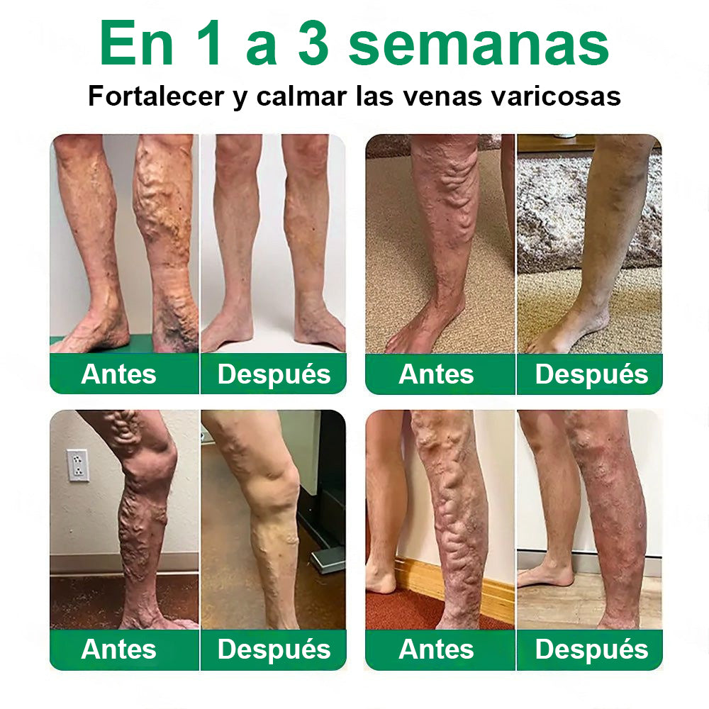 Twisma® VeinTarget – parche avanzado con microtecnología para varices 🦵🔥 Resultados visibles en solo 7–14 días  ⚡ 96 % de eficacia clínicamente comprobada 🌿 Efecto de apoyo suave para piernas más ligeras y relajadas 💪