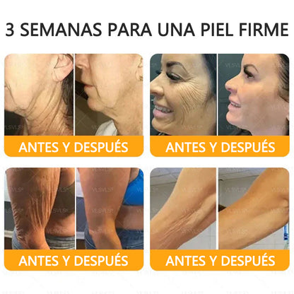 ✨Twisma® Veneno de Abeja Crema Renovadora de Piel con 🔥 ÚLTIMO DÍA 80% DE DESCUENTO 🐝