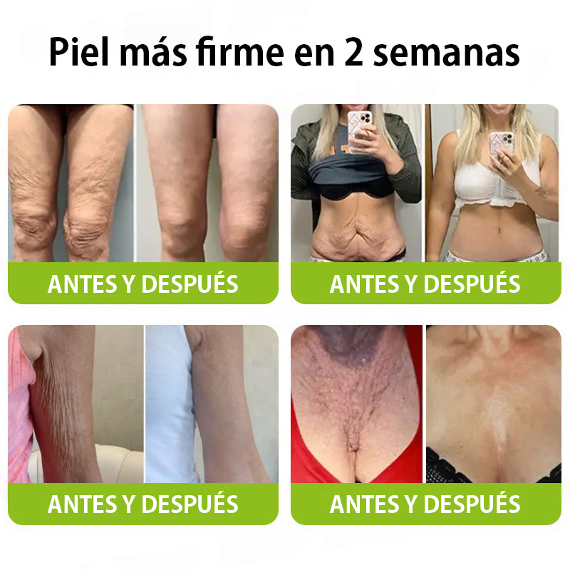 Vosxu™ Botox & Vita-A Retinol Shot sérum lifting antiarrugas ✨ – 💉 Microagujas | 💪 Péptidos con efecto botox | 🌿 Retinol | ⚡ Resultados visibles en 3 días 💎