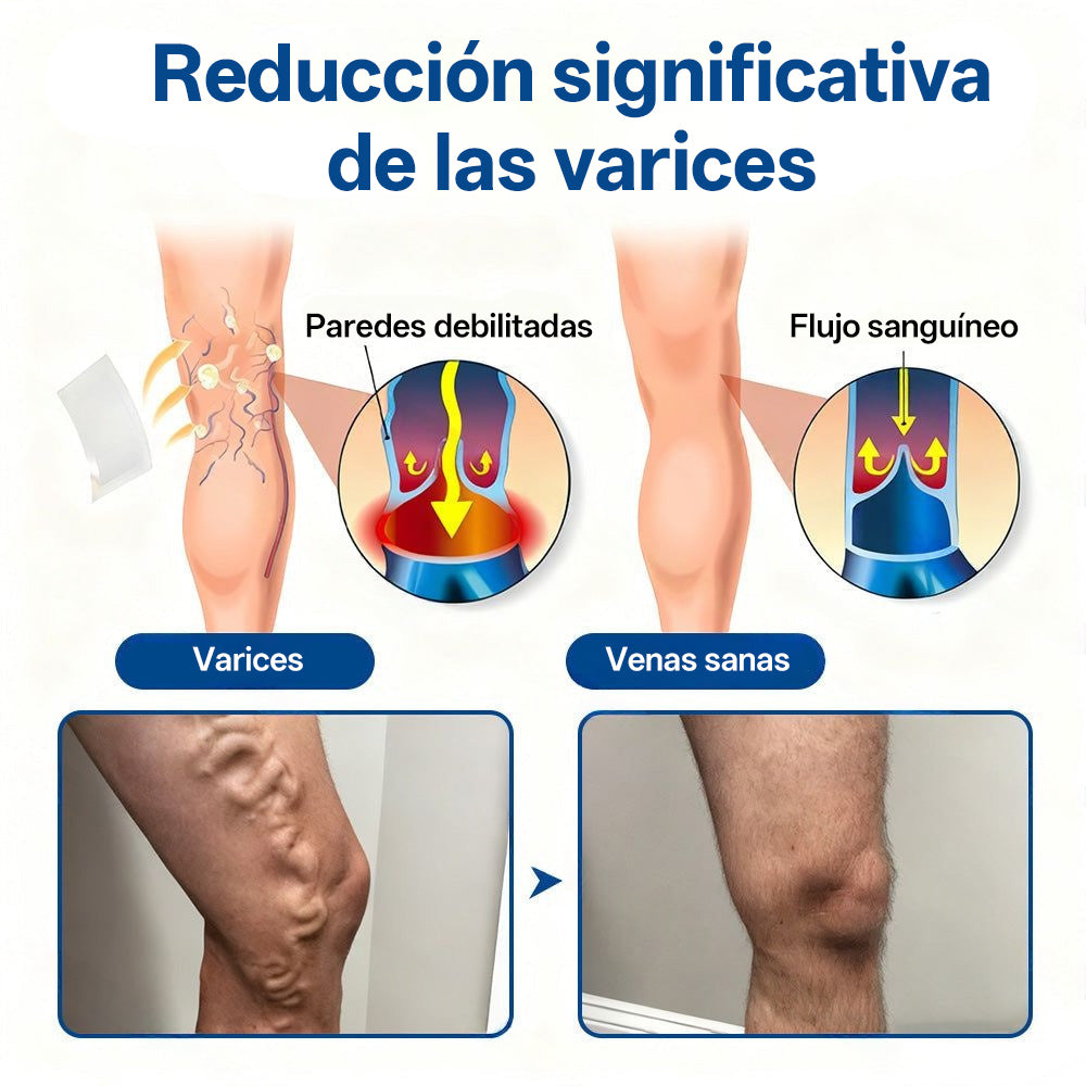 Tainun® VeinTarget Parche de Microagujas Herbal para las Venas 🌿 El primer parche de microagujas con hierbas alpinas certificado por la Unión Europea 🇪🇺 Clínicamente probado con una tasa de éxito de hasta el 96% 📊 Resultados visibles en 7–14 días 🔥🔥
