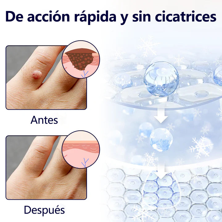 Tainun® ChillErase – spray reparador de cicatrices de acné ✨ | Elimina de forma segura verrugas, marcas y pequeñas protuberancias en casa ✅