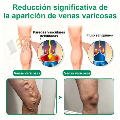 Twisma® VeinTarget – parche avanzado con microtecnología para varices 🦵🔥 Resultados visibles en solo 7–14 días  ⚡ 96 % de eficacia clínicamente comprobada 🌿 Efecto de apoyo suave para piernas más ligeras y relajadas 💪