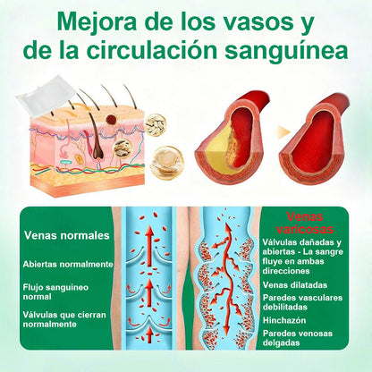 Twisma® VeinTarget – parche avanzado con microtecnología para varices 🦵🔥 Resultados visibles en solo 7–14 días  ⚡ 96 % de eficacia clínicamente comprobada 🌿 Efecto de apoyo suave para piernas más ligeras y relajadas 💪
