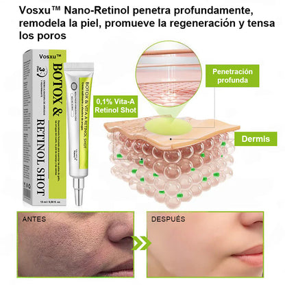 Vosxu™ Botox & Vita-A Retinol Shot sérum lifting antiarrugas ✨ – 💉 Microagujas | 💪 Péptidos con efecto botox | 🌿 Retinol | ⚡ Resultados visibles en 3 días 💎