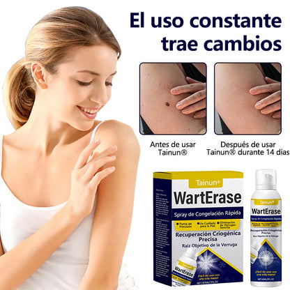 Tainun® ChillErase – spray reparador de cicatrices de acné ✨ | Elimina de forma segura verrugas, marcas y pequeñas protuberancias en casa ✅