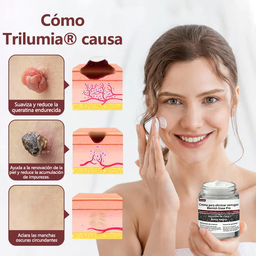 Oferta especial de Navidad: Trilumia® Cremа Pro para eliminar verrugas y marcas 🧑‍⚕️  ¡ÚLTIMO DÍA con 80% de DESCUENTO! 🔥