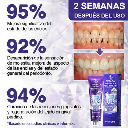 Guxar® VioCore Pasta Dental de Propóleo 🦷 Alivio del dolor dental en 3 días · Regeneración de las encías en 7 días · Prevención de la enfermedad periodontal · Combinación perfecta de veneno de abeja y minerales naturales 🌟