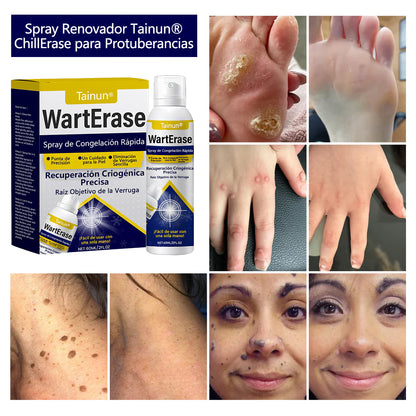 Tainun® ChillErase – spray reparador de cicatrices de acné ✨ | Elimina de forma segura verrugas, marcas y pequeñas protuberancias en casa ✅