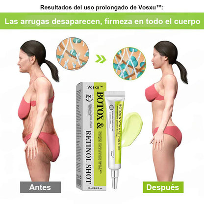 Vosxu™ Botox & Vita-A Retinol Shot sérum lifting antiarrugas ✨ – 💉 Microagujas | 💪 Péptidos con efecto botox | 🌿 Retinol | ⚡ Resultados visibles en 3 días 💎